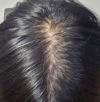 ヘアミラクル3週目の体験談