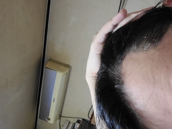 뒷부분을 쭉 눌러주니 젤 타입으로 나오는데 흐르지 않고 도포한곳에 딱 붙어있어서 너무 좋네요