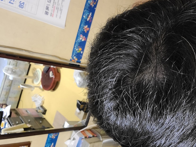 정수리