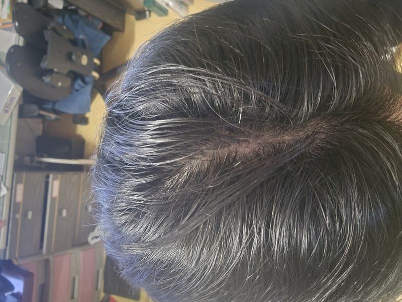 블랙포레 두피정화 4주차 후기