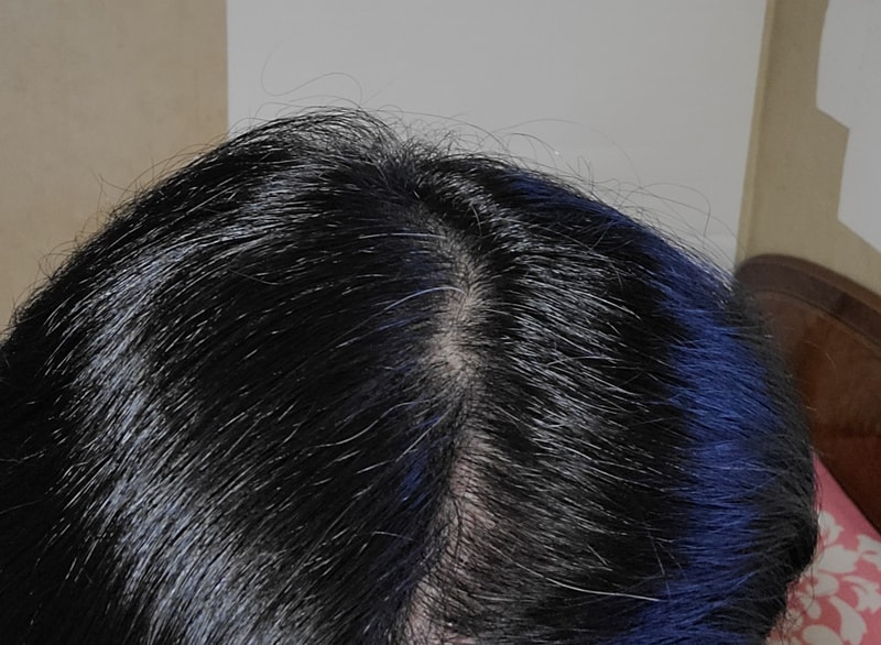 オンユビオチン4週目の体験談