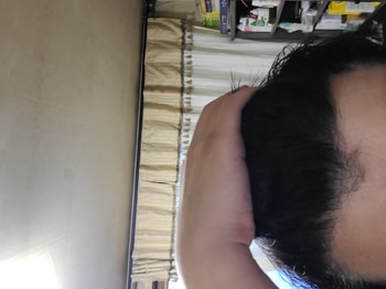 헤어라인도