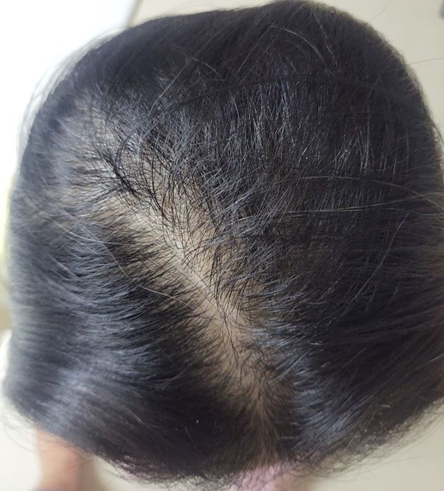 유베르나 마지막 후기 입니다.