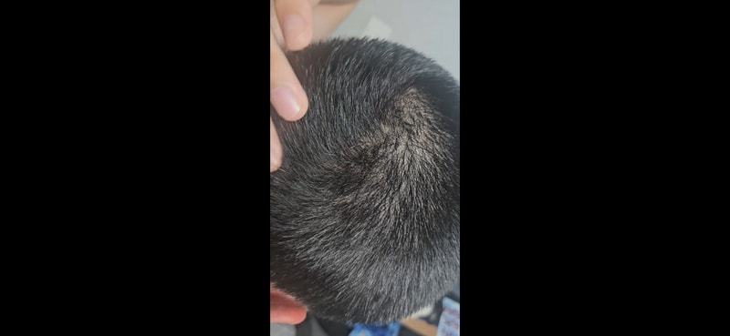 닥터포헤어 4주차 후기