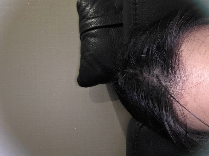 ニュープレミアムTSシャンプー1台駐車体験談です。