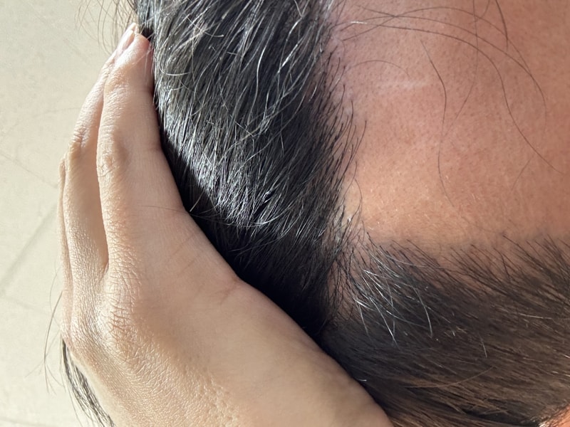 모발이식러 판토모나 4주차 후기 남깁니다!