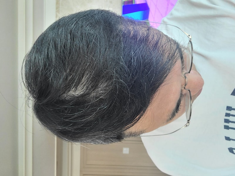 헤어미라클 7주차 후기