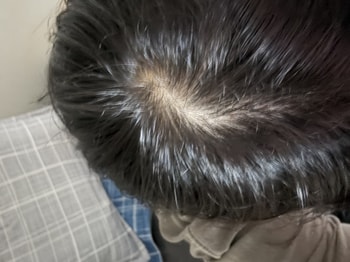 12주 사용 후