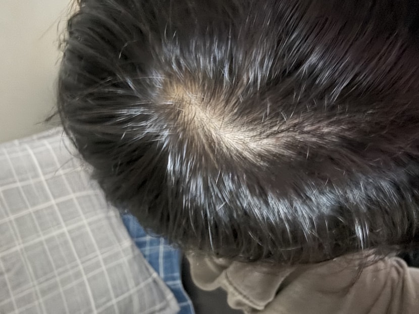 12주 사용 후