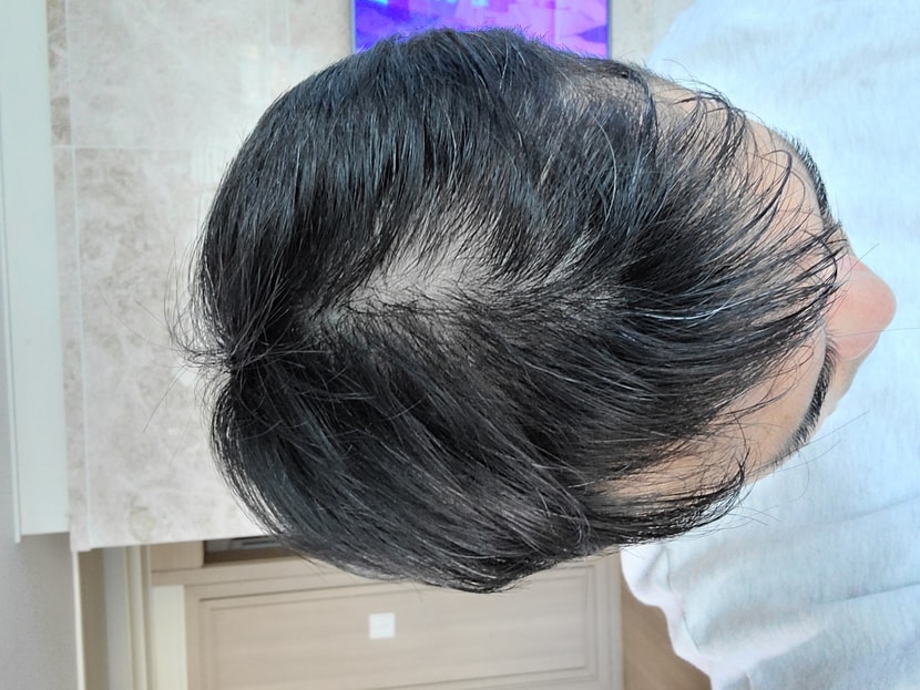 이게 2주차 초에 찍은 사진입니다.