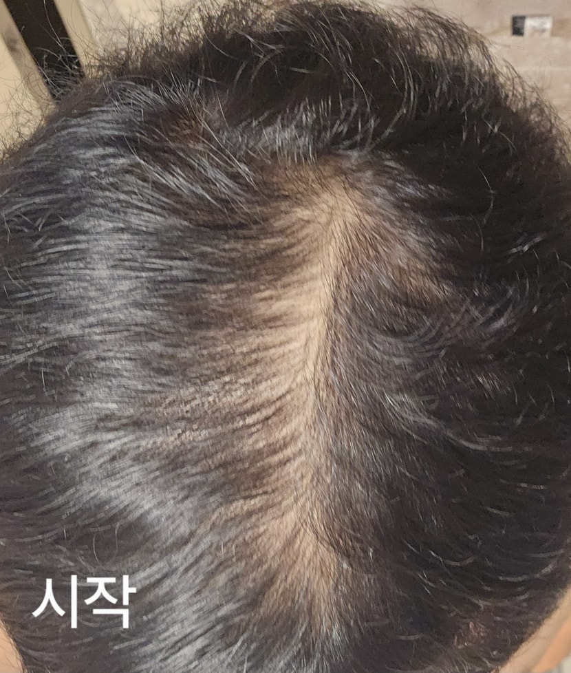 첫시작