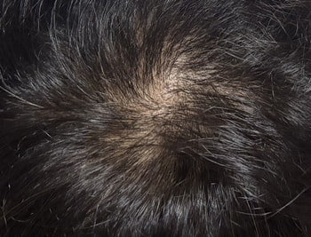 2주차 머리상태