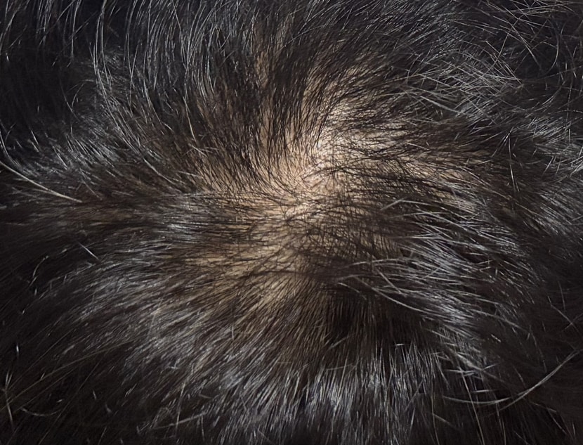 2주차 머리상태