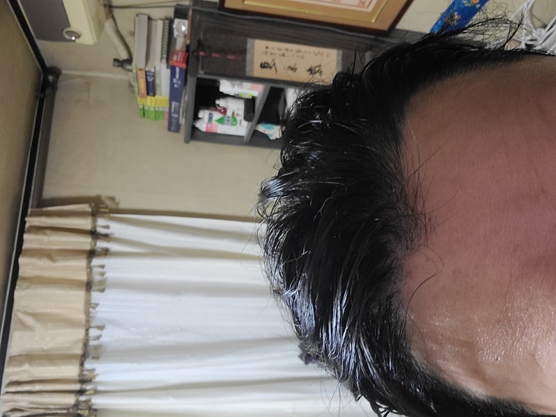 豪姆三周后期