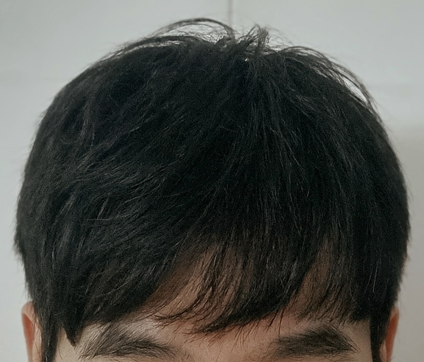 2주차 두발 사진