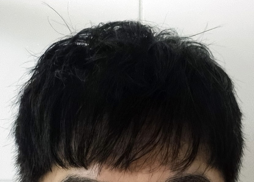 케어이후 모발상태