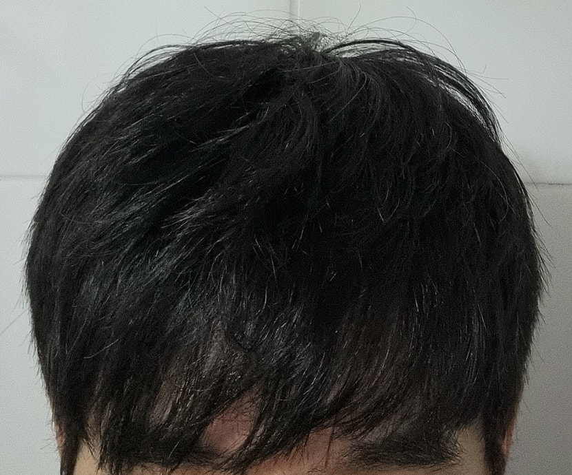 제품 사용전 두발 사진