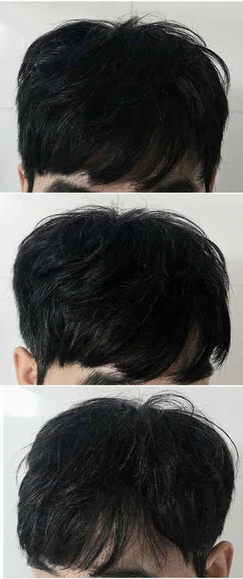 스칼프 사용 머리 말린 후(밀도/볼륨감 증가)