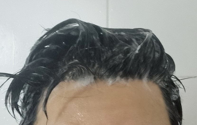 더블 솔트 두피스케일러