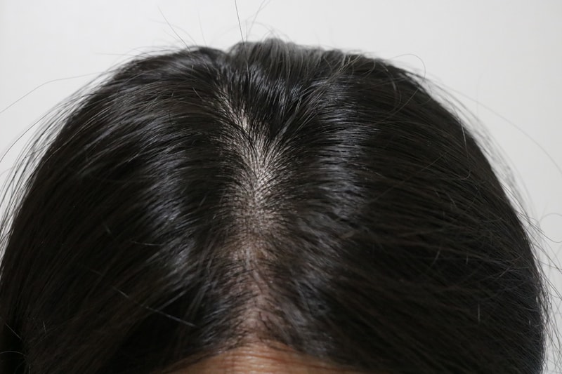 ブラックフォーレ3週目の体験談