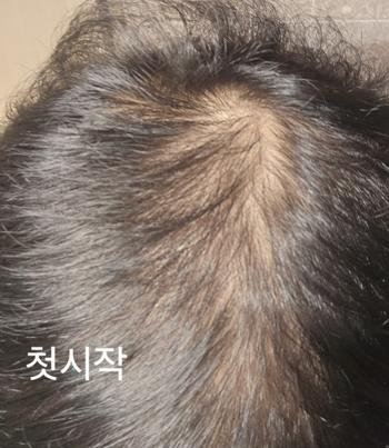 첫시작