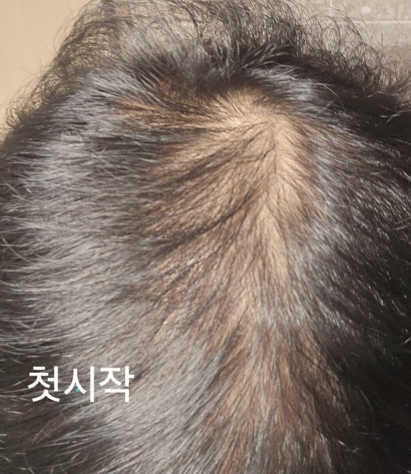 첫시작
