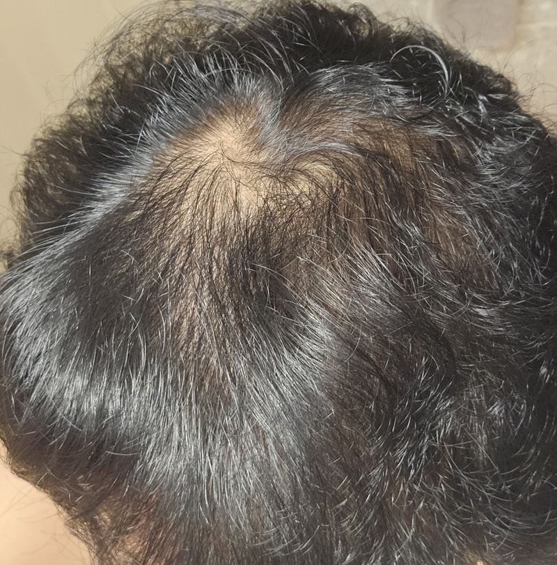 ブラックフォーレ クール ディープクリーン 4週目の体験談