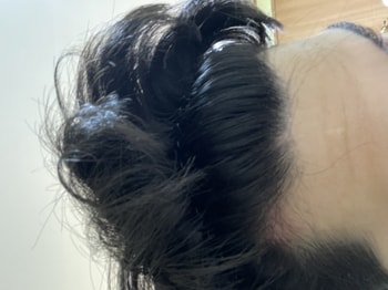 아베다스칼프 사용전