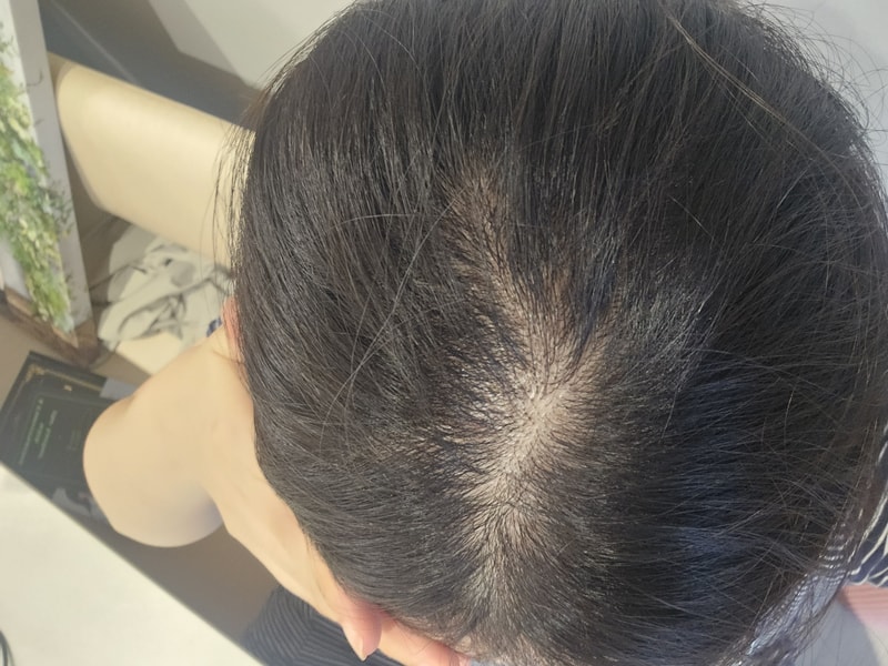 [ブラックフォーレルートパワーシャンプー] 2週目体験談 豊かな泡 涼しい頭皮