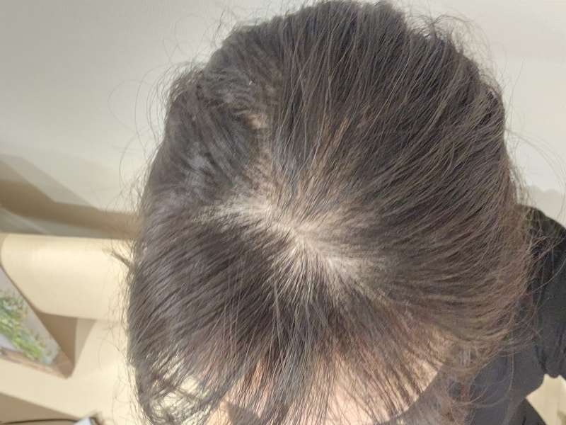 [BLACK FORE ROOT POWER洗发水] 3周后记