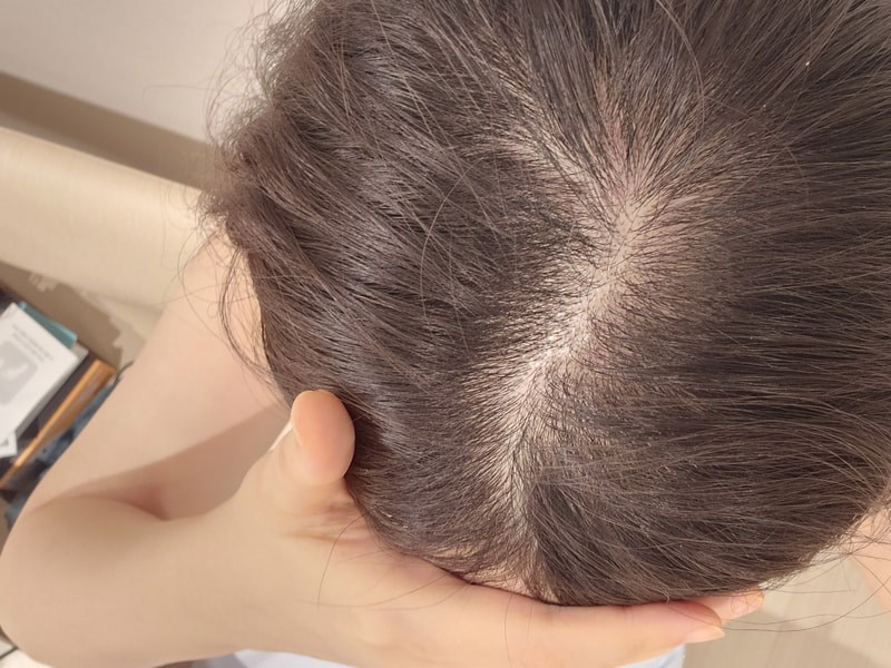 [Black Forree Root Power洗发水 第4周] 是最终后记