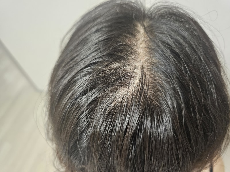 [ブラックフォーレルートパワーシャンプー] 涼しい1週目の体験談