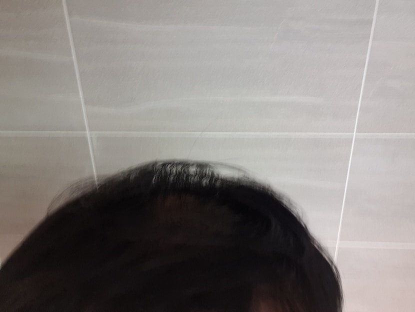 두타민 도포 후
