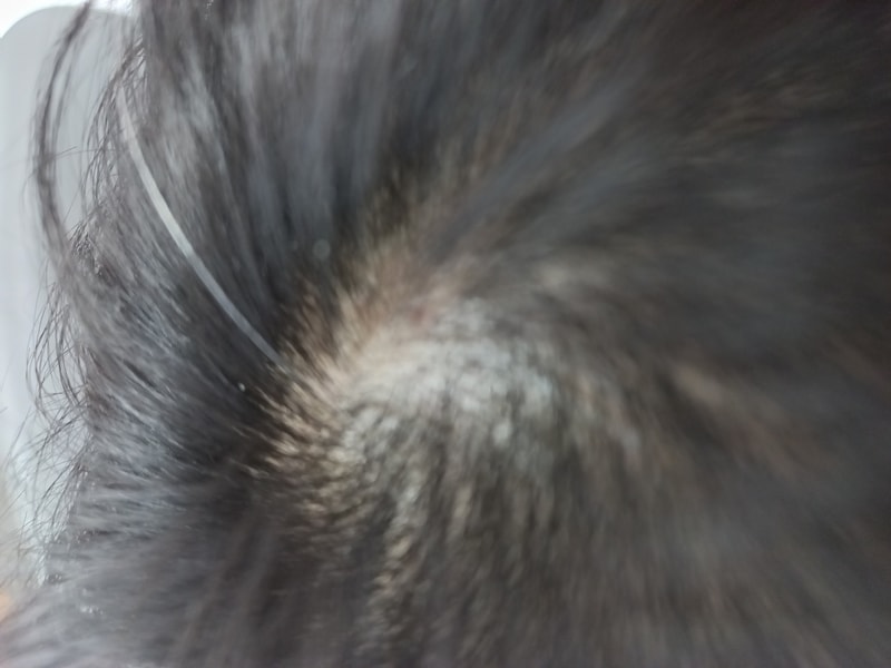 &lt;2週目&gt;ソイシディル製品群使用中体験談