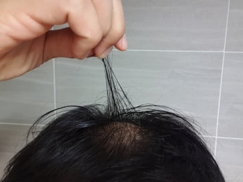 두타민 도포 후 뻣뻣해진 머리카락^^ (풀면 풀려요)