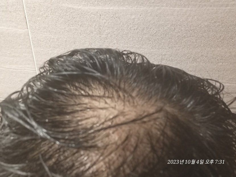 샴푸 후
