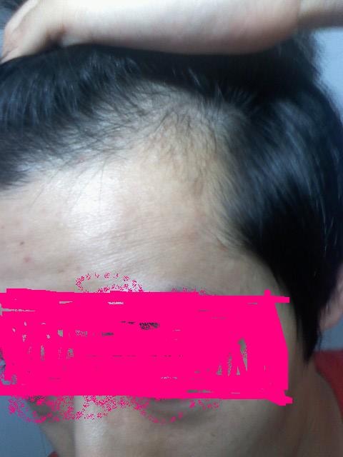 애경 에스따르 탈모샴푸 신청합니다.<접수완료>