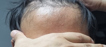 닥터 포헤어 3주차 입니다.