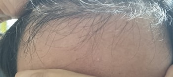 닥터 포헤어 2주차 입니다.