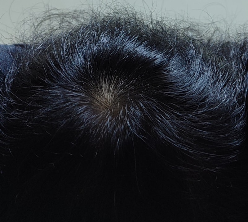 모제림 X 세라젬 8주차 후기