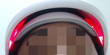메디헤어 사용 9회차!