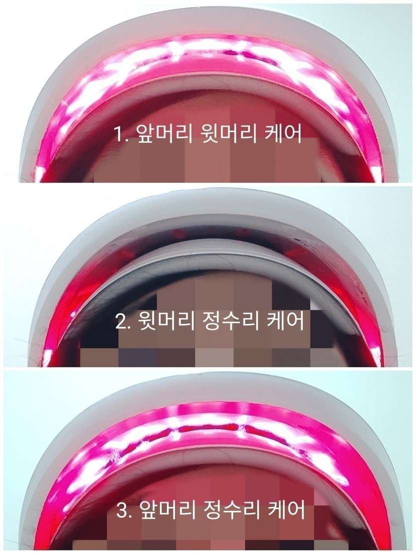 부위별로 레이저를 쏘아주는 모습!