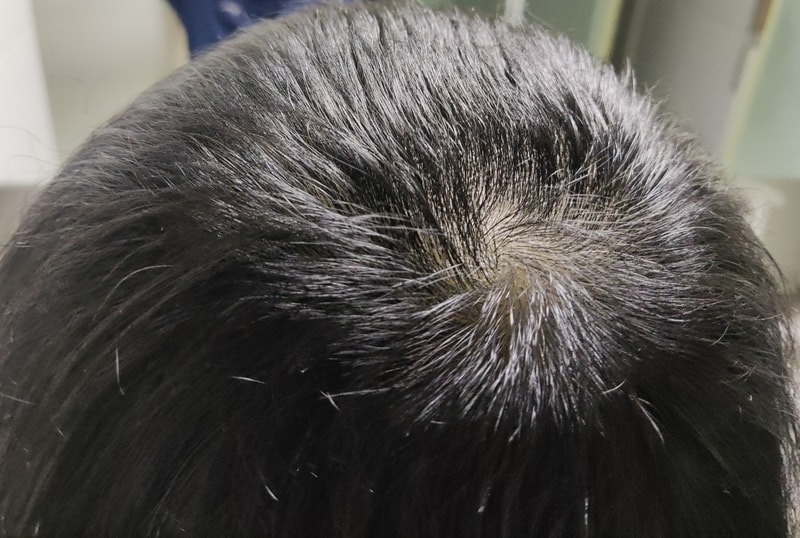 [ブラックフォーレ炭酸クーリング] 使用4週目体験談