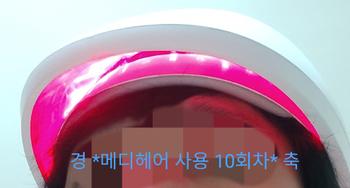 두피세포야 마구 활성화되어라!