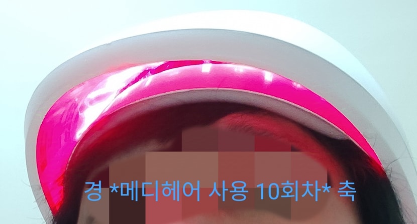 두피세포야 마구 활성화되어라!