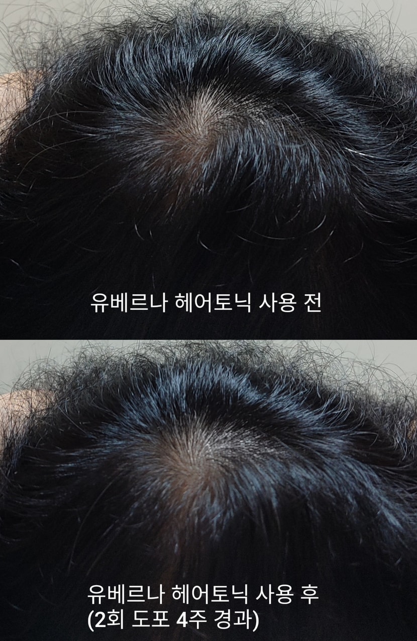 고민되는 정수리ㅠ