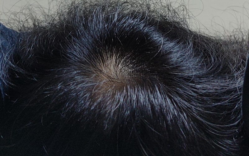 모제림 X 세라젬 7주차 후기