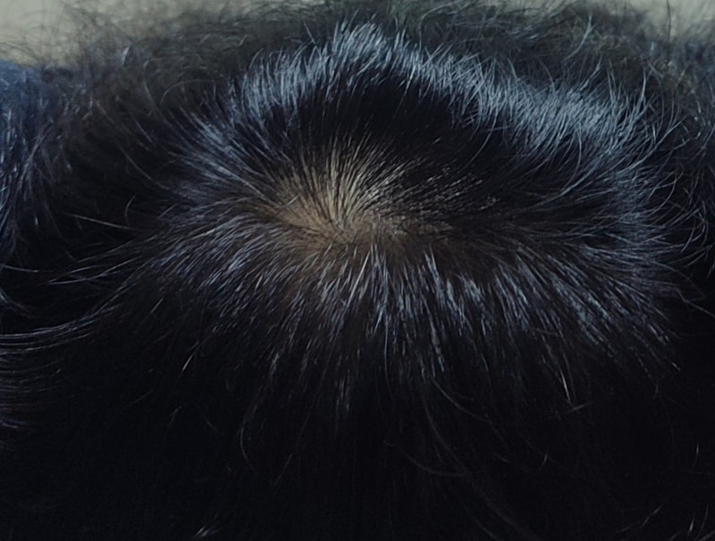 모제림 X 세라젬 6주차 후기