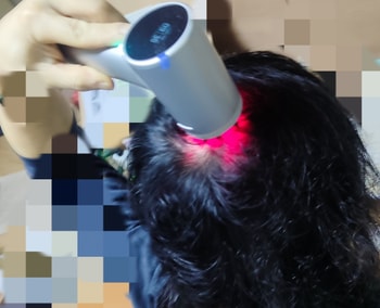 두피케어는 매일! 돈드는거 아닌데 안하면 손해조!