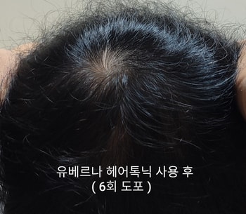 유베르나 헤어토닉 사용 후